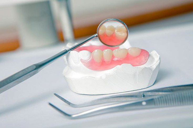 Съемные зубные протезы. Стоматология "Евродент" в Черкесске
